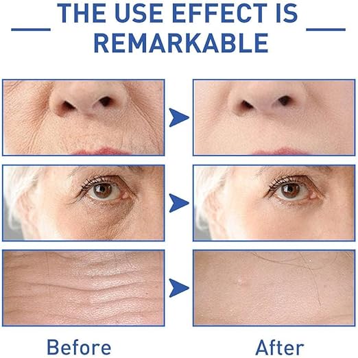 SADOER Retinol Caffeine Eye Cream – Anti-Wrinkle Hydrating UAE | Pickzaar