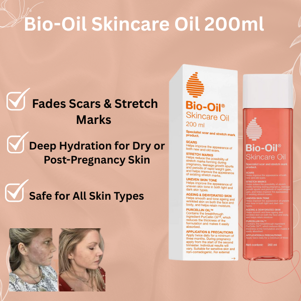 Bio‑Oil Skincare Oil – Specialist Scar, Stretch Mark & Skin Tone Repair (200 ml)