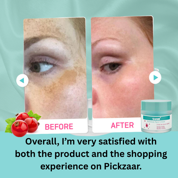 SAAM Renewal Face Cream – 50g for Melasma, Freckles & Pigmentation