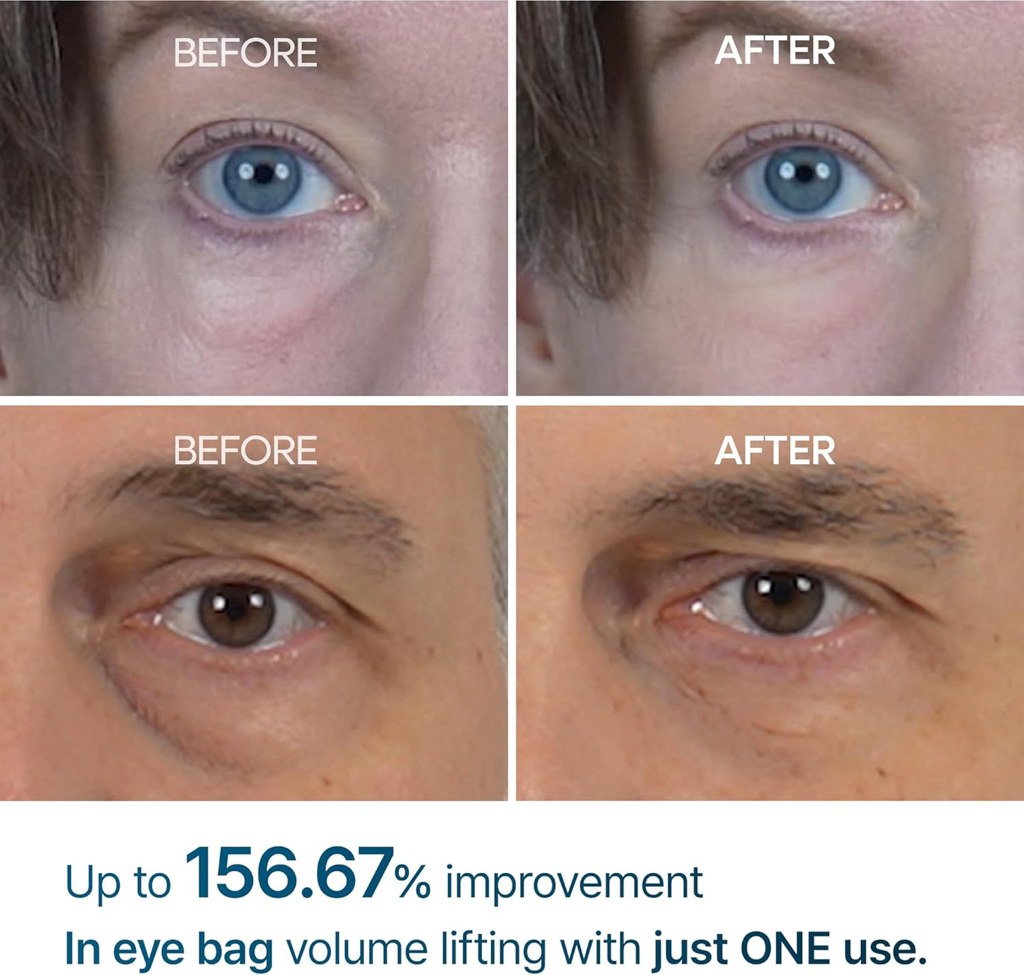 Dr.Melaxin Eyephalt Eyebag Cream – EGF Anti-Aging Under Eye Cream for Puffiness, Dark Circles & Wrinkles