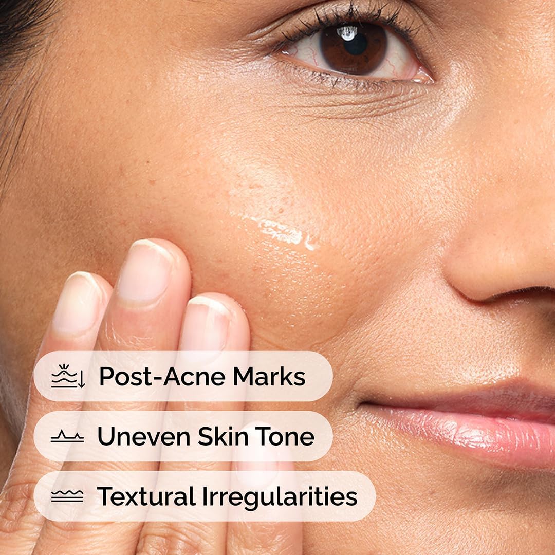 Aloe 2% + NAG 2% Solution – Even Tone & Redness Serum