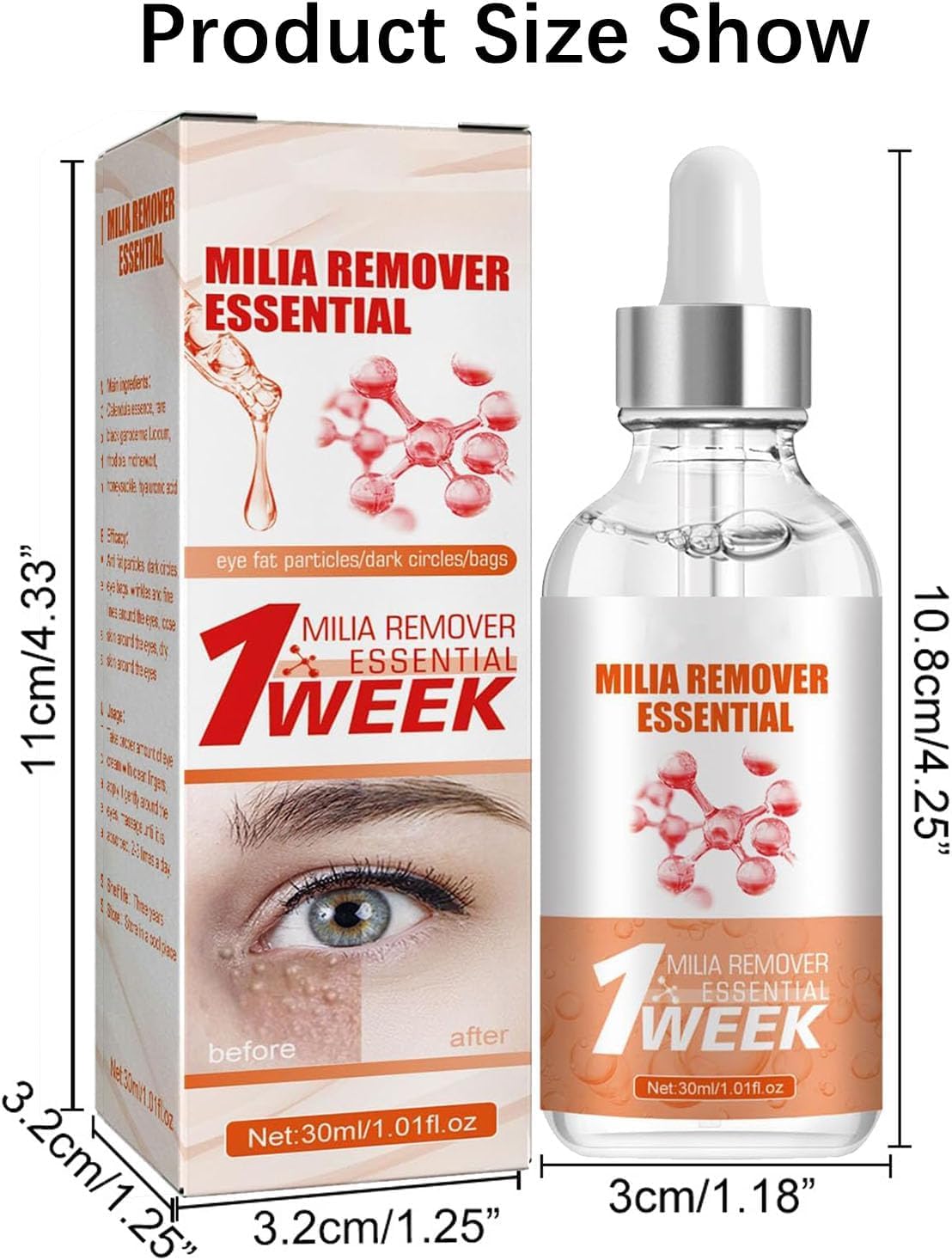 Azonee Speedy Milia Remover Serum – 30ml