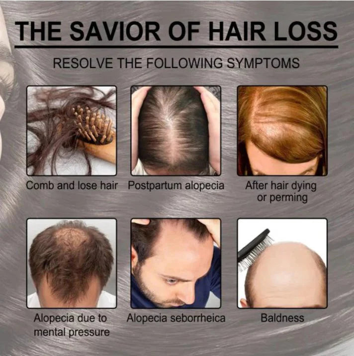 EELHOE Rosemary Hair Growth + Anti-Breakage Oil – 30ml Nourish, Strengthen & Regrow Naturally