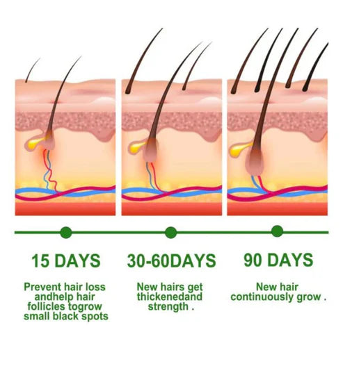 EELHOE Rosemary Hair Growth + Anti-Breakage Oil – 30ml Nourish, Strengthen & Regrow Naturally