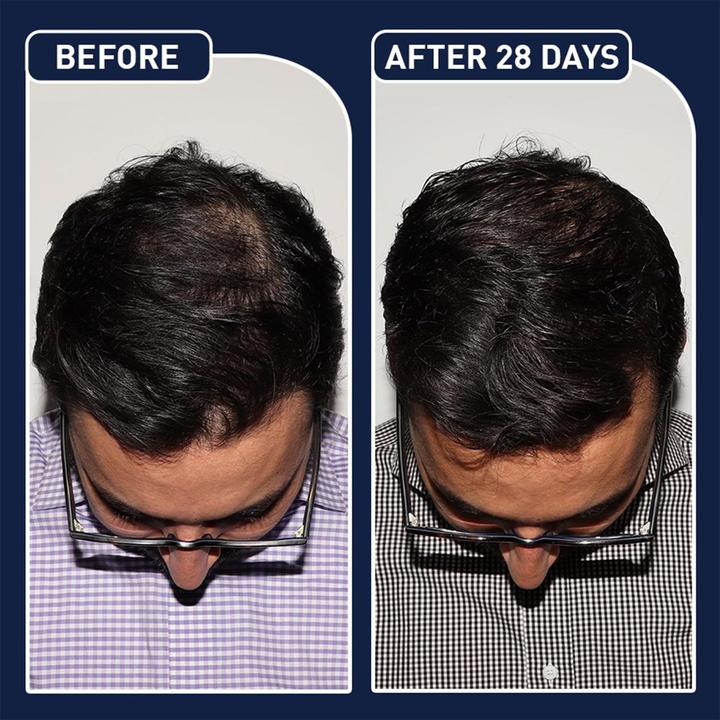 FEGPLUS Hair & Beard Growth Serum – 50ml