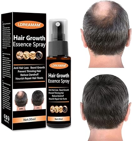 Hair Regrowth Spray – Anti-Hair Loss Serum with Herbal Extracts (30ml)