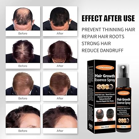 Hair Regrowth Spray – Anti-Hair Loss Serum with Herbal Extracts (30ml)