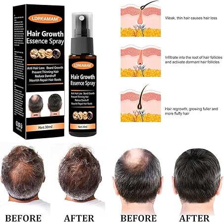 Hair Regrowth Spray – Anti-Hair Loss Serum with Herbal Extracts (30ml)