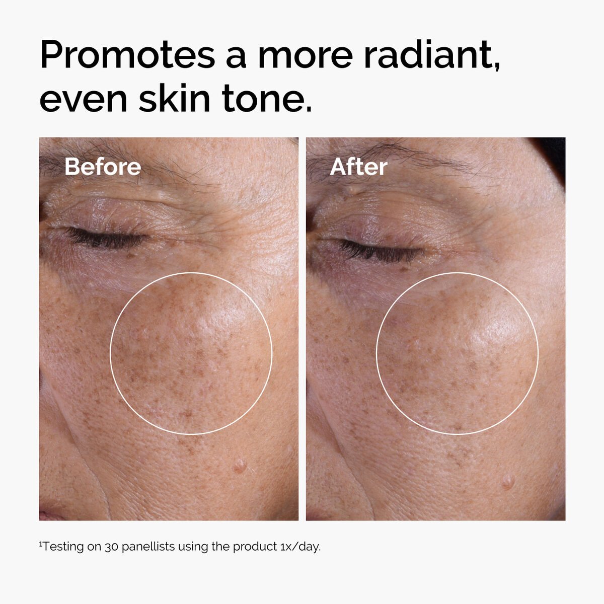 The Ordinary Glycolic Acid 7% Exfoliating Toner – 100ml Daily Glow-Boosting Toner for Smoother, Radiant Skin