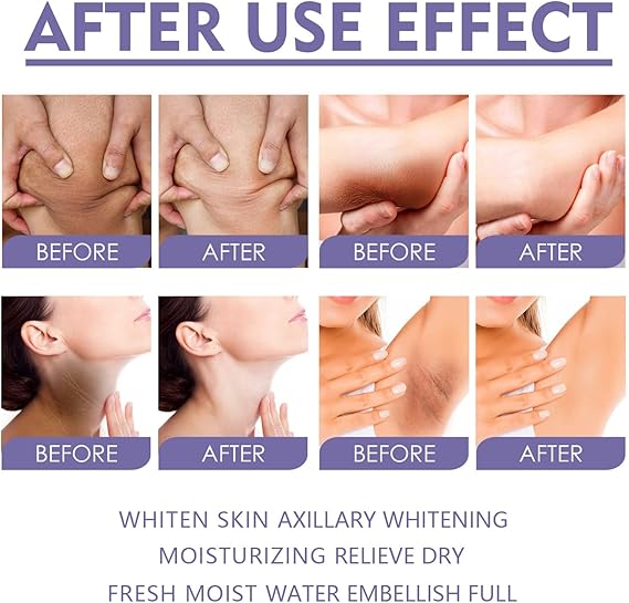 Underarm Whitening Cream Stick – Dark Spot Corrector for Armpits, Knees & Elbows (40g)