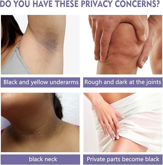 Underarm Whitening Cream Stick – Dark Spot Corrector for Armpits, Knees & Elbows (40g)