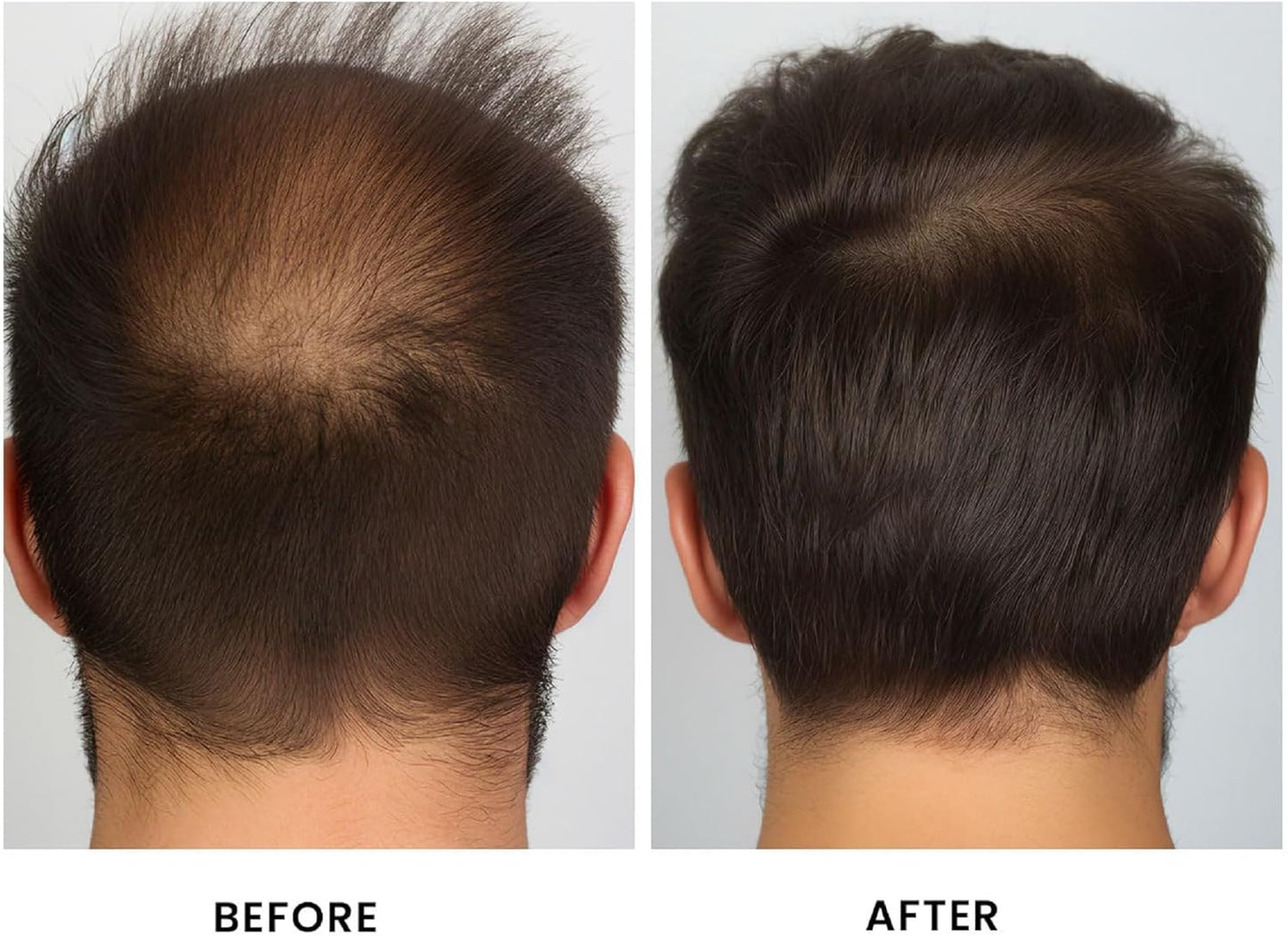 WHITE GAINS Batana Oil Hair Cream – 100g | 100% natural, vitamin-rich & proven in UAE