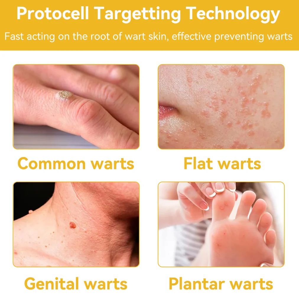 Bee Skin Elixir – Natural Bee Venom & Herbal Acne Cream for Clear Skin, (60g