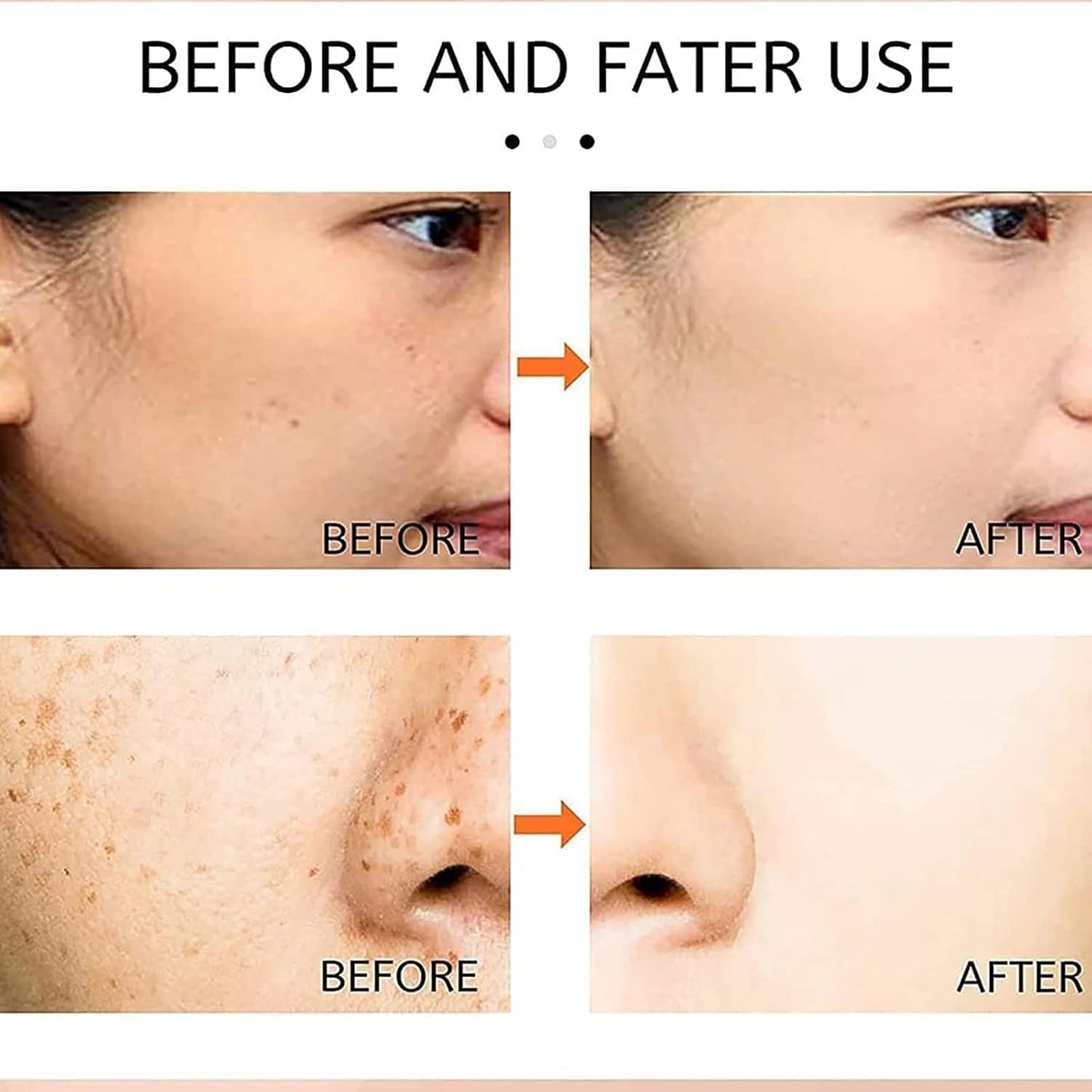 Japanese Melasma Cream | Dr. Hancy Dark Spot Corrector for Melasma, Freckles &amp; Age Spots – Gentle, Hydrating &amp; Brightening Face Cream
