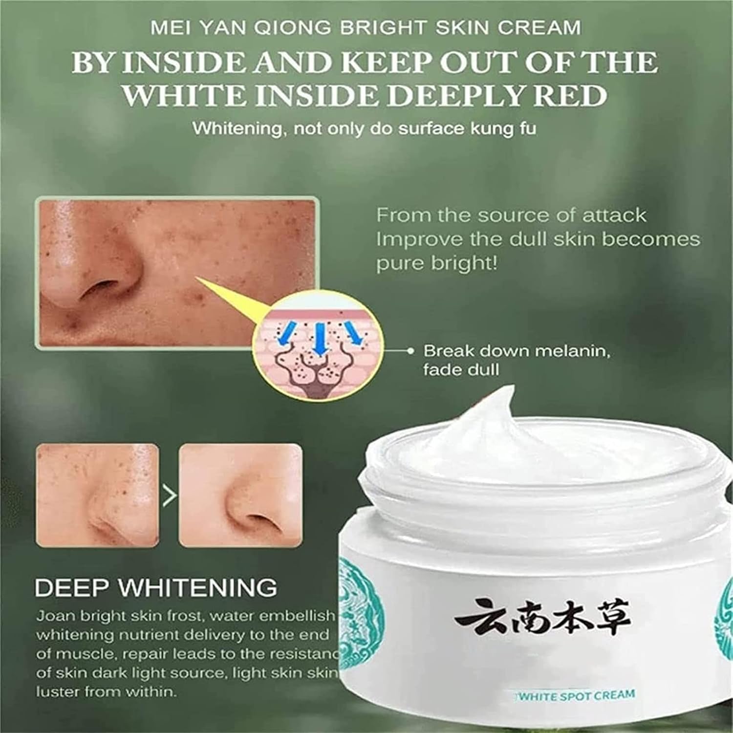 Japanese Melasma Cream | Dr Hancy White Spot UAE & KSA– Pickzaar