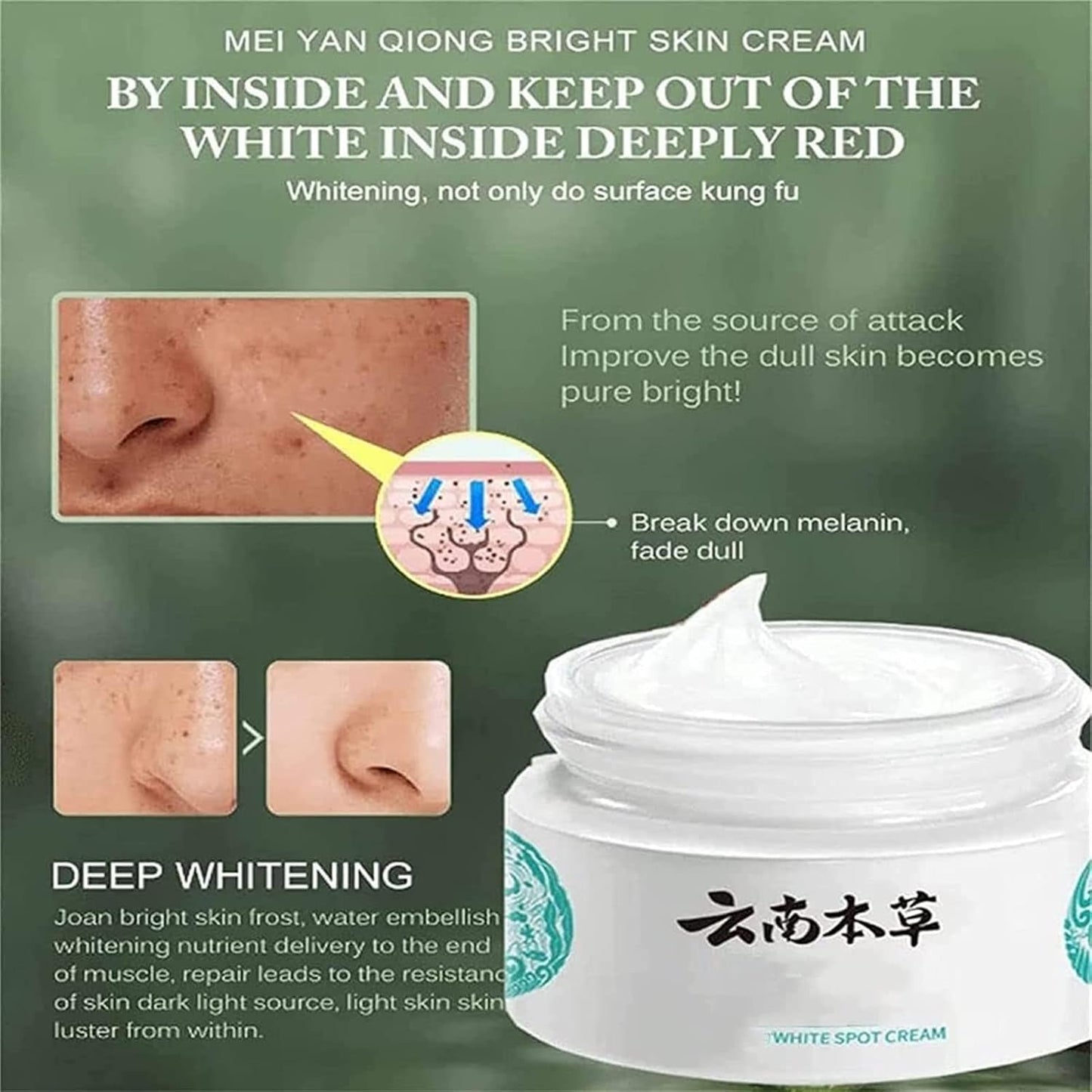 Japanese Melasma Cream | Dr. Hancy Dark Spot Corrector for Melasma, Freckles &amp; Age Spots – Gentle, Hydrating &amp; Brightening Face Cream