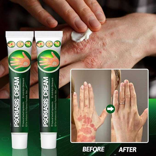 Herbal Psoriasis Cream – Plant Extract Hydrating & Soothing Skin Care (Unisex)