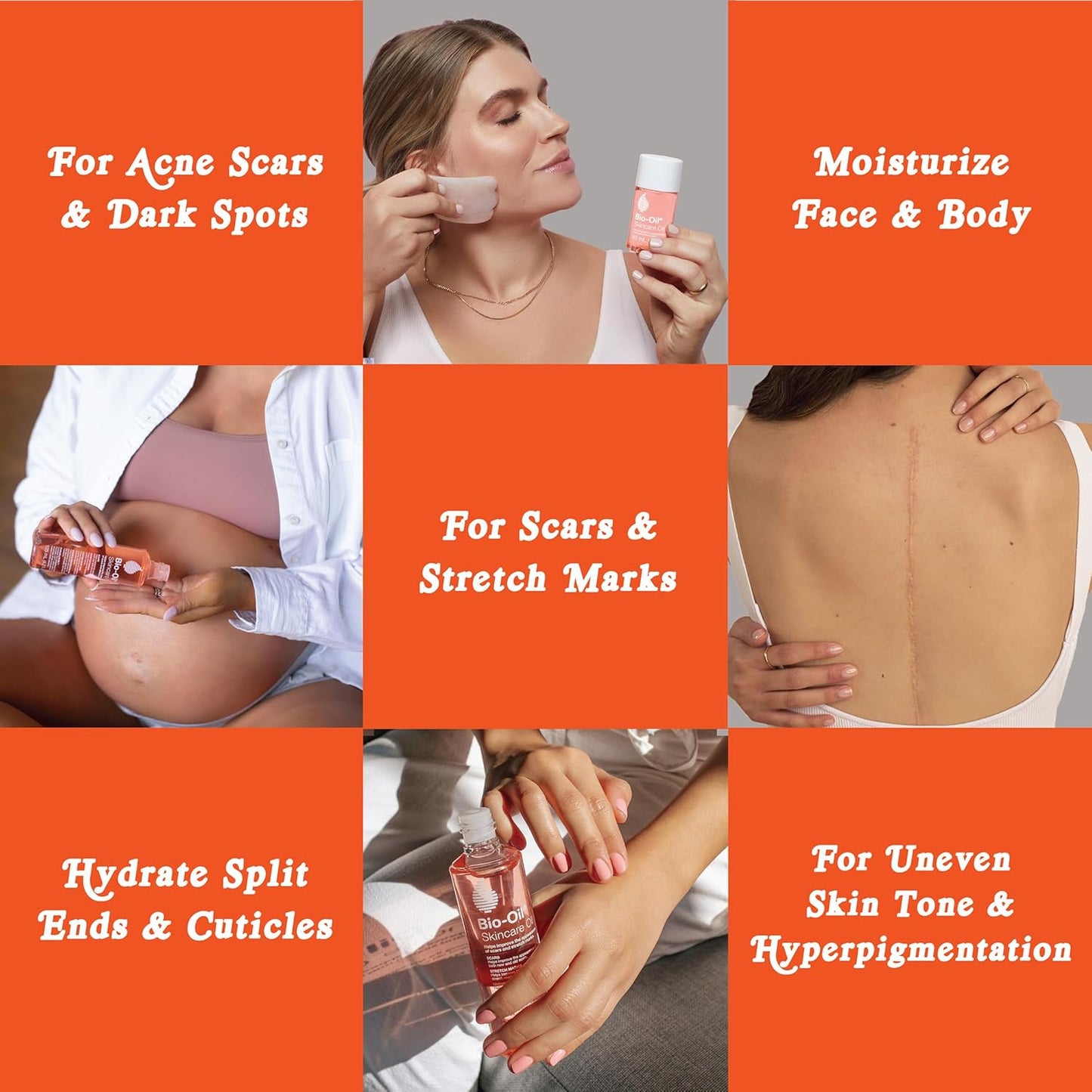  Bio-Oil Skincare Oil 200ml – Stretch Mark & Scar Solution