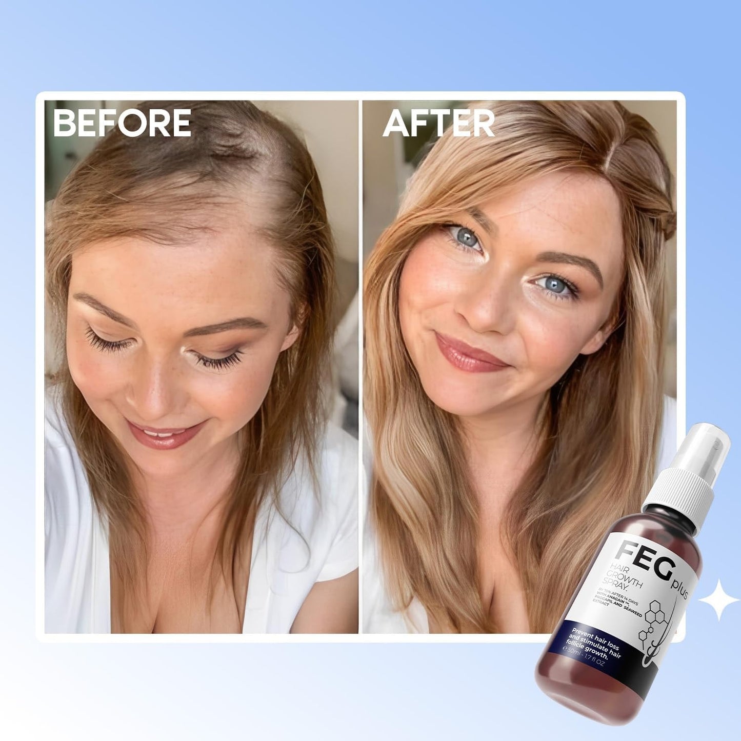 FEGPLUS Hair & Beard Growth Serum – 50ml