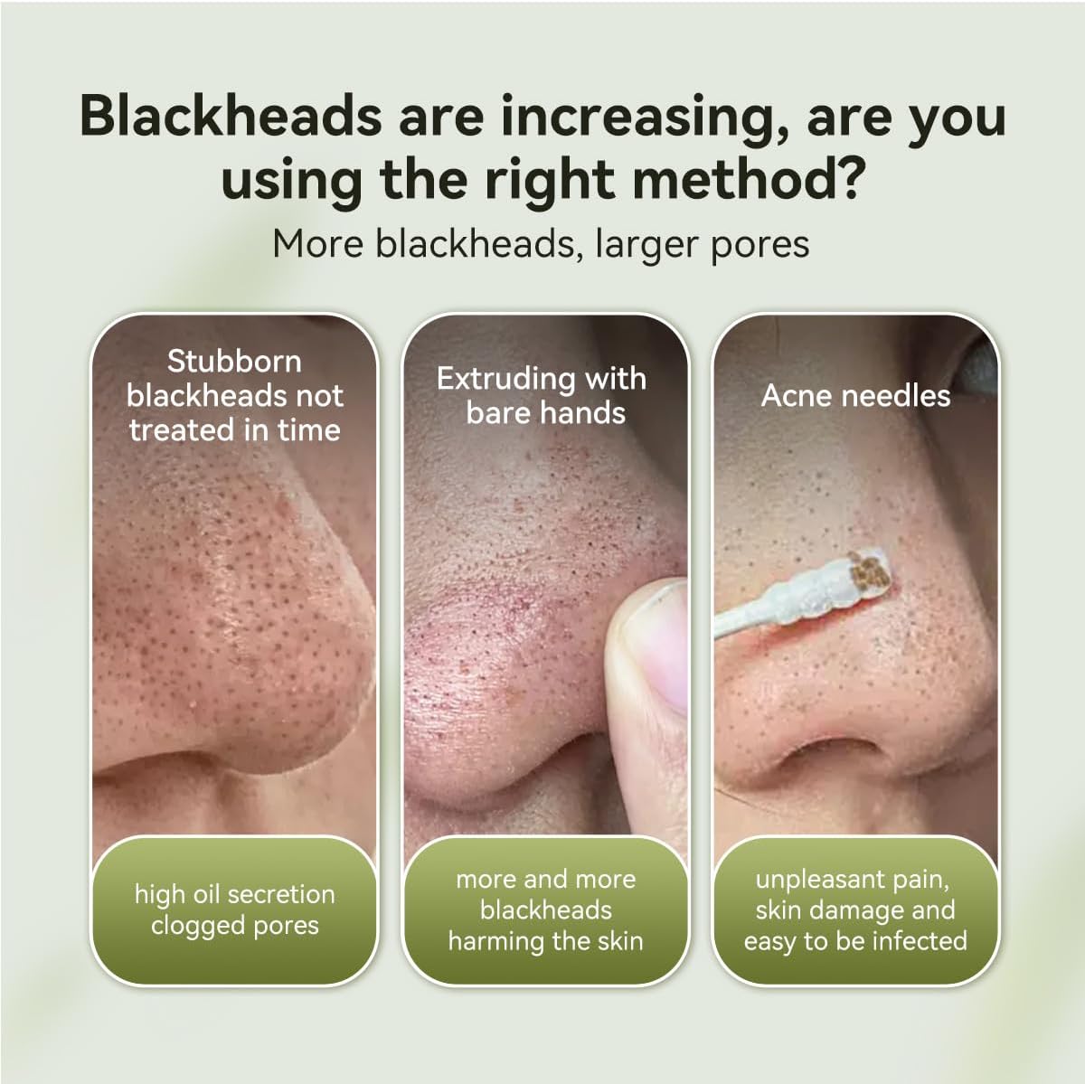 LANBENA 2.0 Blackhead Remover Peel-Off Mask
