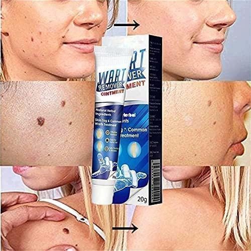 Wart Remover Ointment – Fast-Acting Wart & Skin Tag Removal Cream (20g)