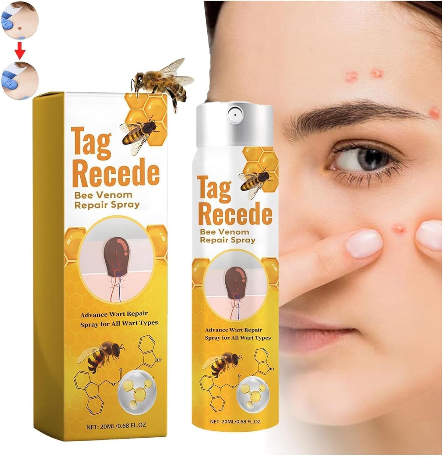 Bee Venom Treatment Spray – P-Venom Smooth Skin Spray 20ml