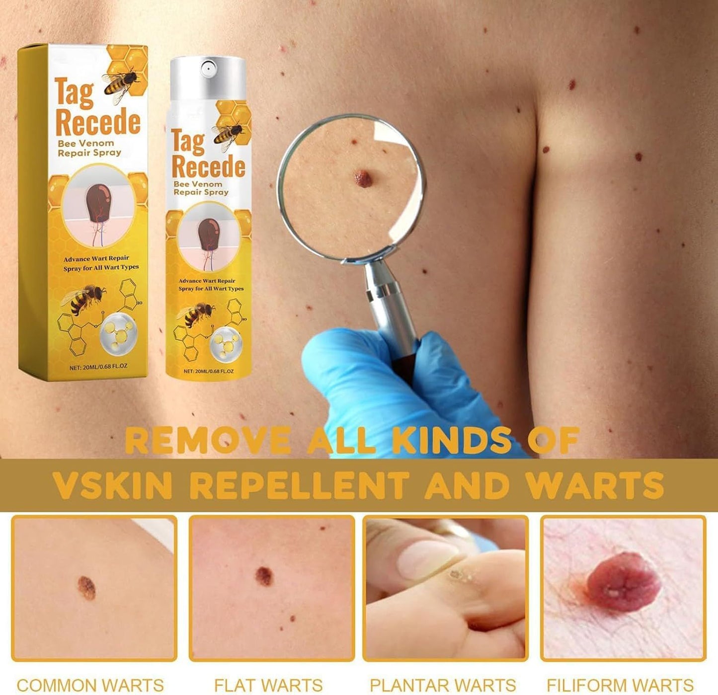 Bee Venom Treatment Spray – P-Venom Smooth Skin Spray 20ml
