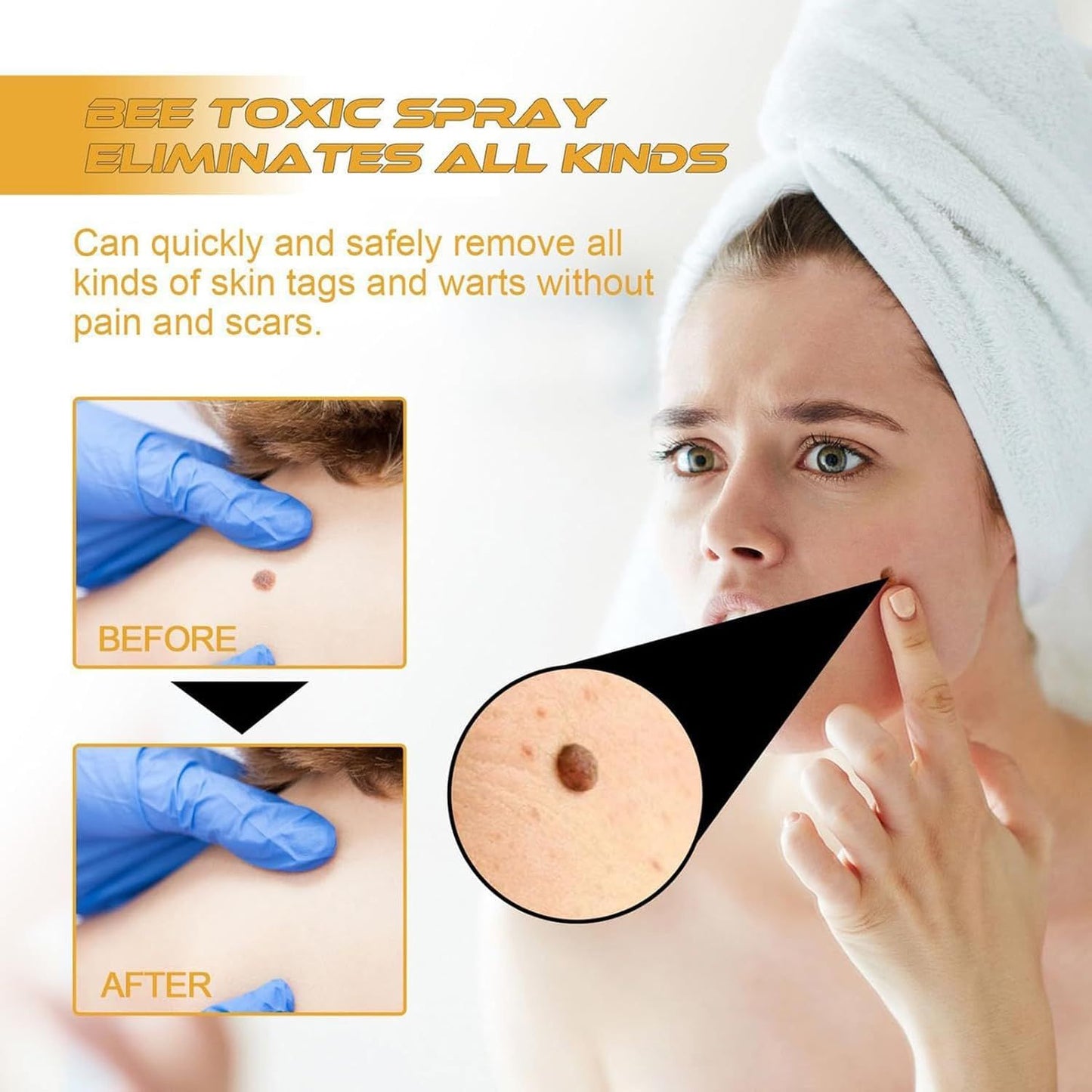 Bee Venom Treatment Spray – P-Venom Smooth Skin Spray 20ml
